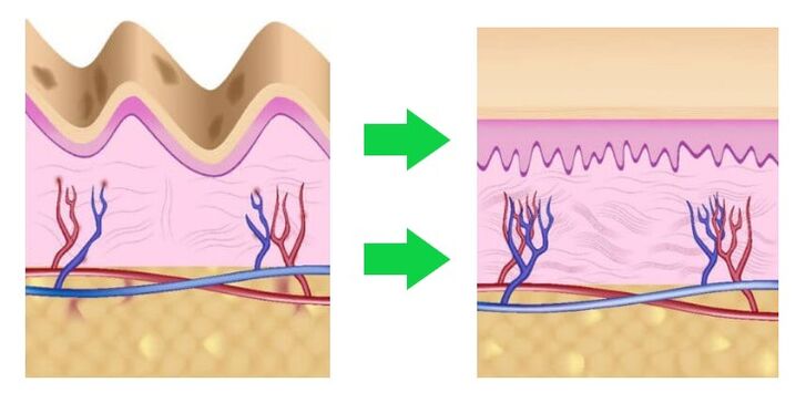 Intenskin aligne la peau